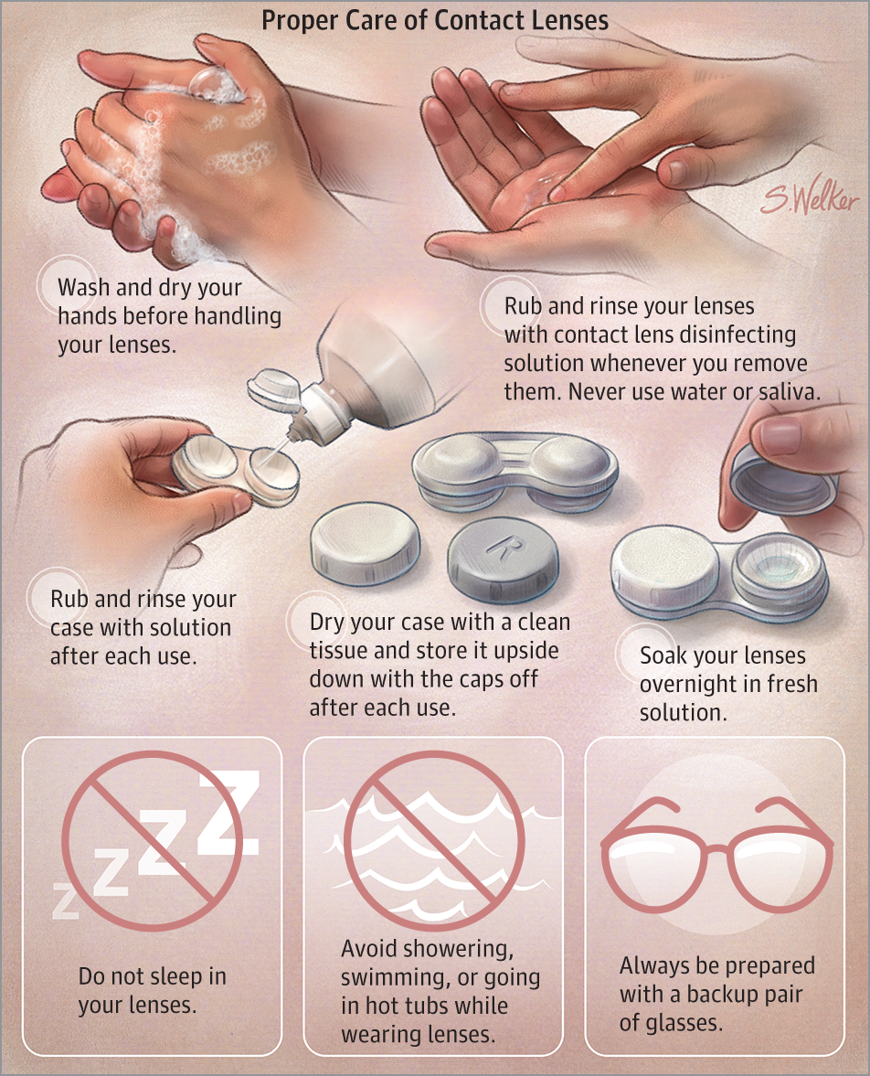 contact lens proper care