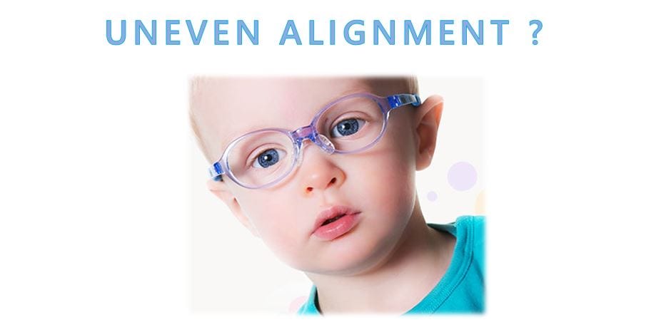 Malaya Optical Uneven Alignment Malaya Optical Uneven Alignment