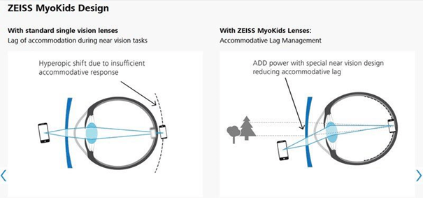 Difference between single vision lenses and Myokids lenses