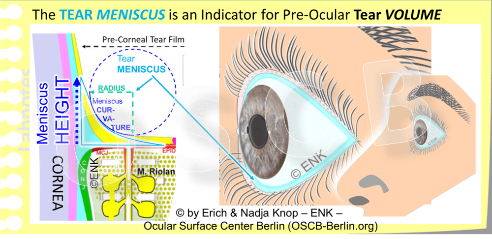 Tear Layer Meniscus