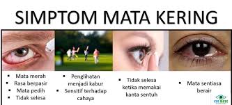 Simptom mata kering