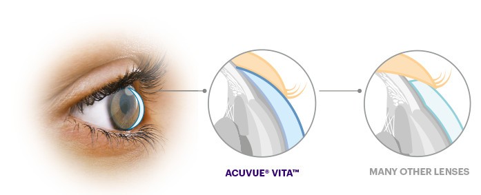 Acuvue Vita Astigmatism