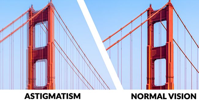 Astigmatism vs normal vision for PureVision2 HD Toric