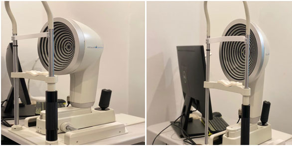 Corneal-Topographer