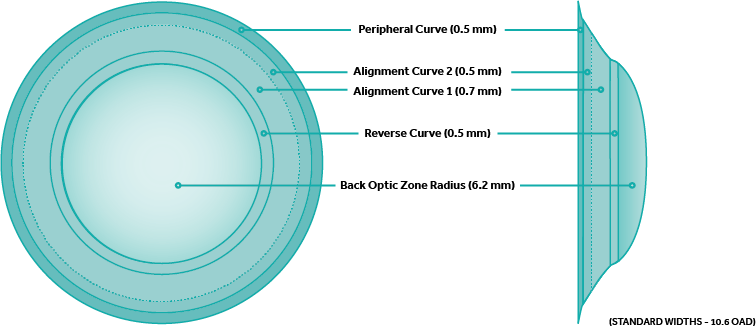 Euclid Orthokeratology near me