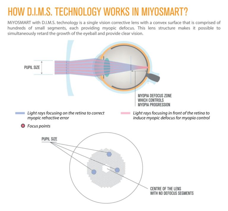 MIYOSMART HOYA LENSES AT MALAYA OPTICAL Optometrist Optical Shop