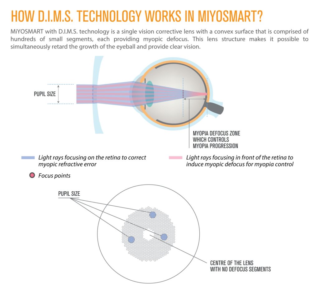 MiyoSmart Hoya Lenses at Malaya Optical
