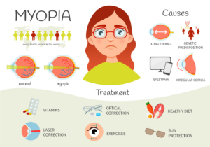 Causes of myopia