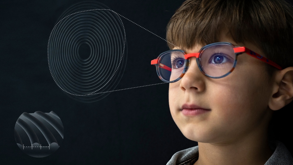 Zeiss Myocare Lenses for Myopia Control