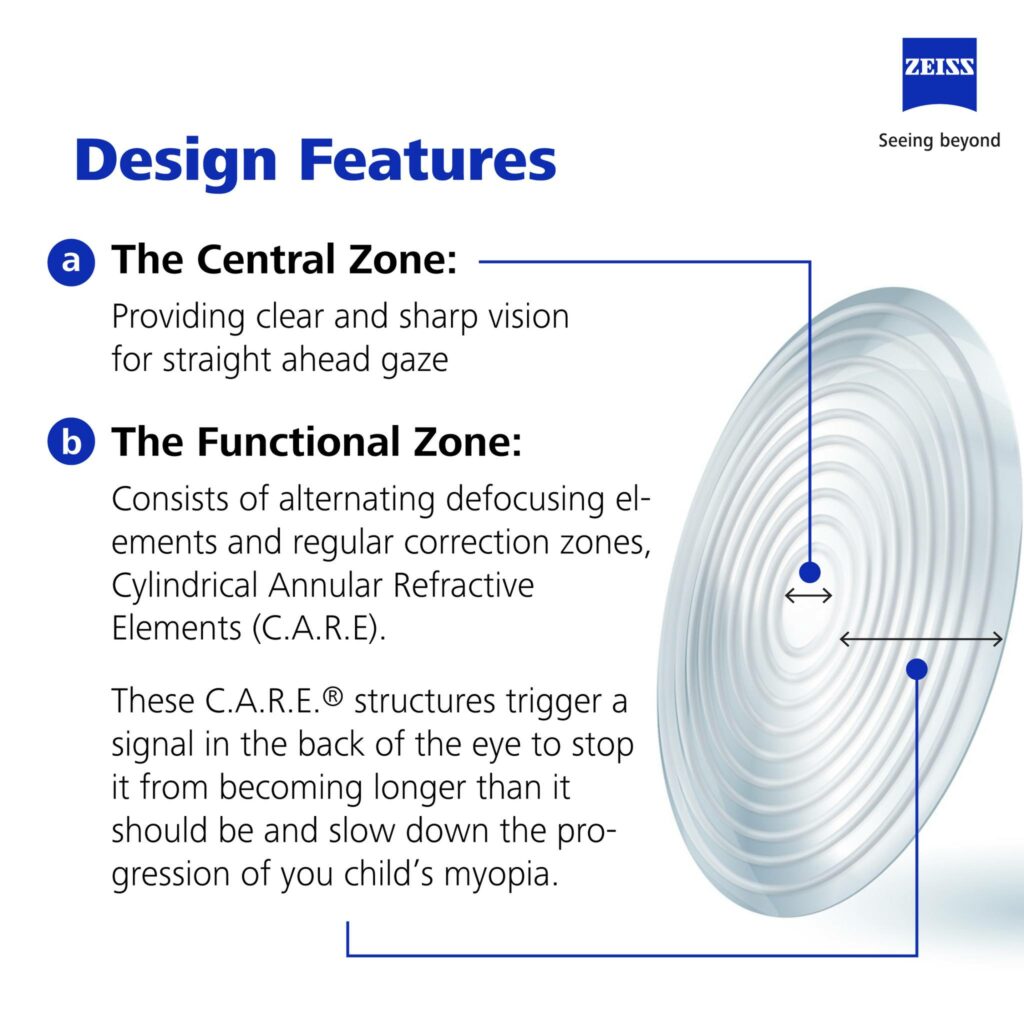 Zeiss Myocare Lenses for Myopia Control