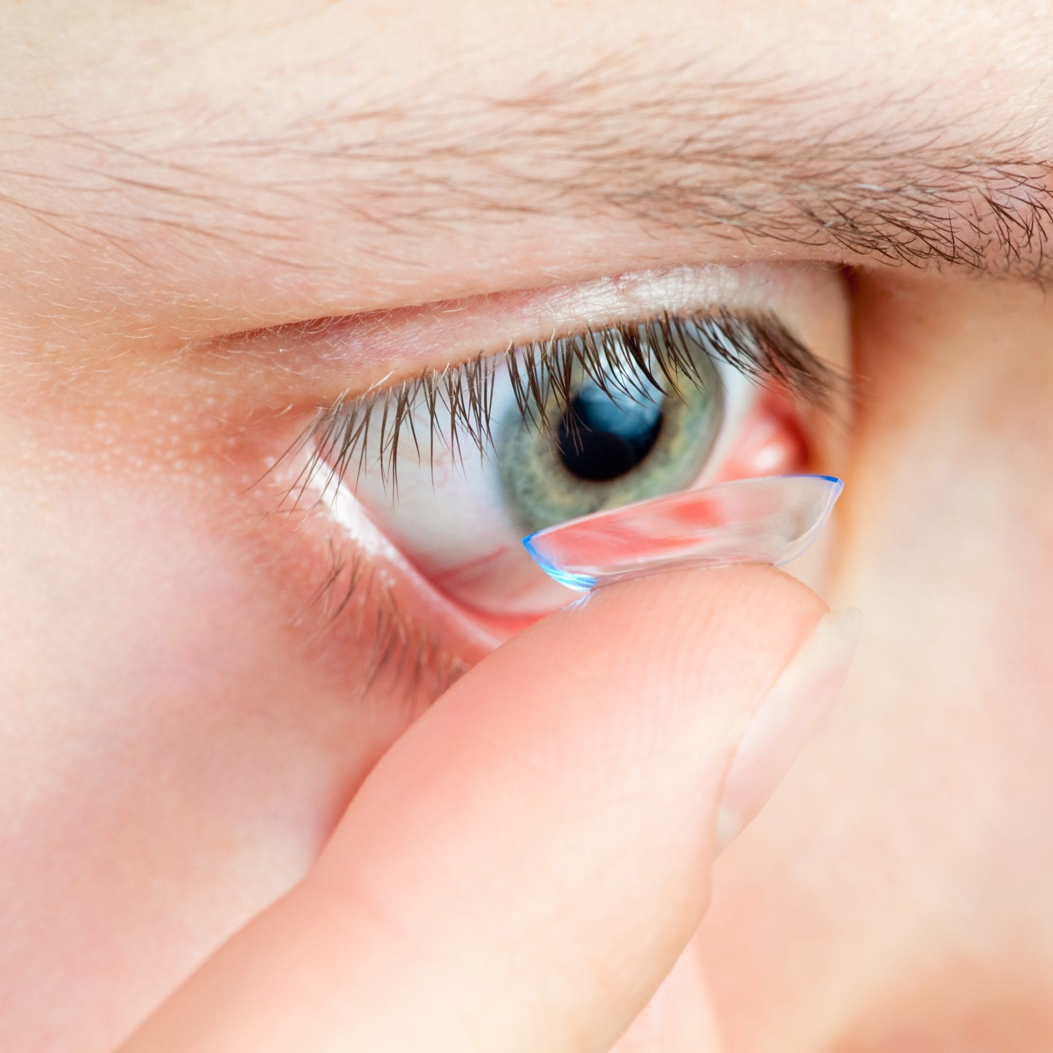 Orthokeratology, Ortho-K for children